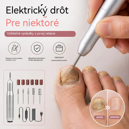 💅👍 Elektrický pilník na nechty používaný na liečbu onychomykózy (plesne nechtov)