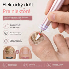 💅👍 Elektrický pilník na nechty používaný na liečbu onychomykózy (plesne nechtov)